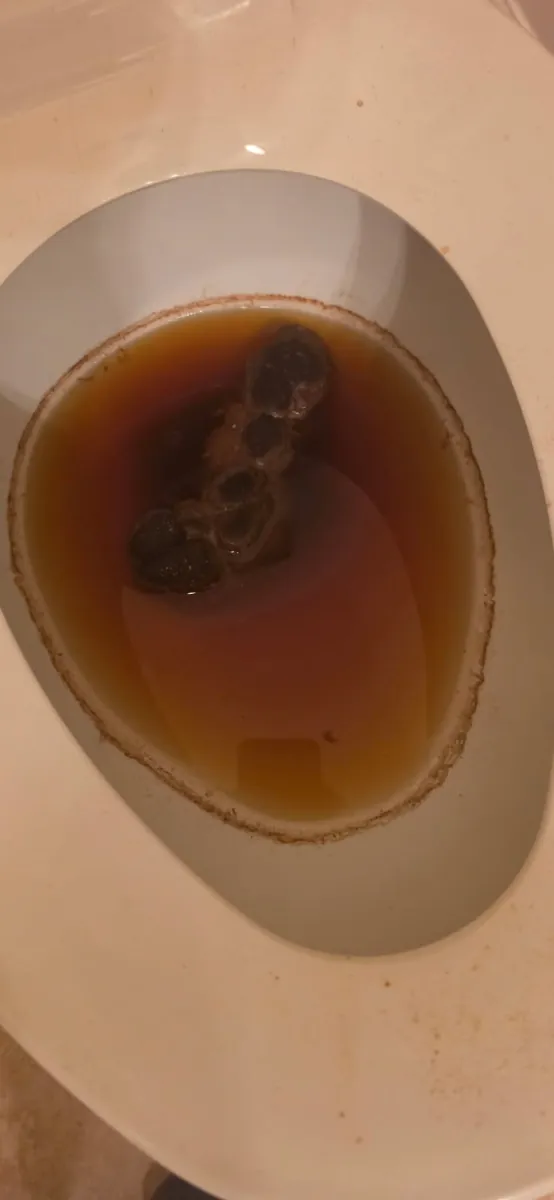 Backed-up toilet bowl in Kentlands, Gaithersburg filled with standing dirty water before the clog was cleared